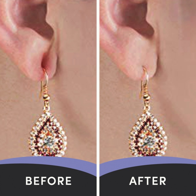 Lobe Miracle, , large