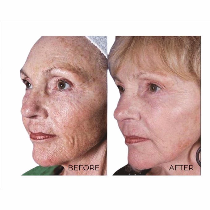Age Spot Cream , , large