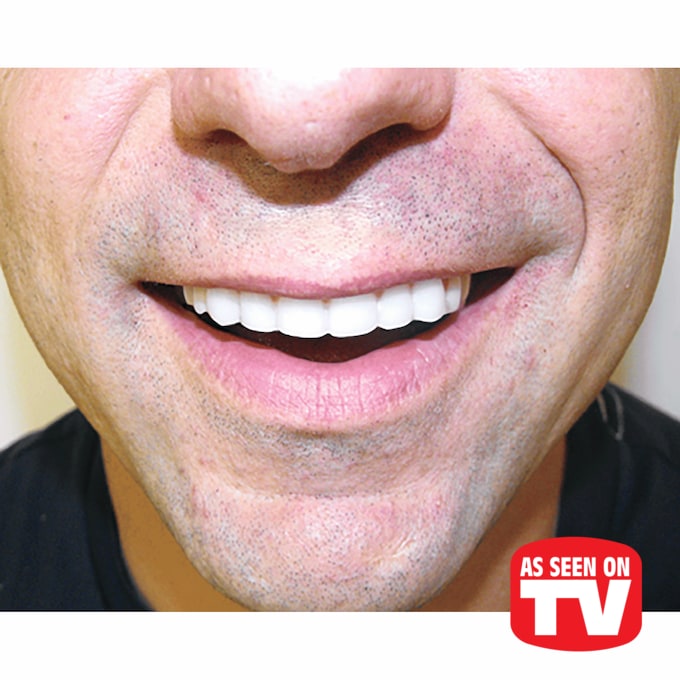 Instant Smile Veneer, , large